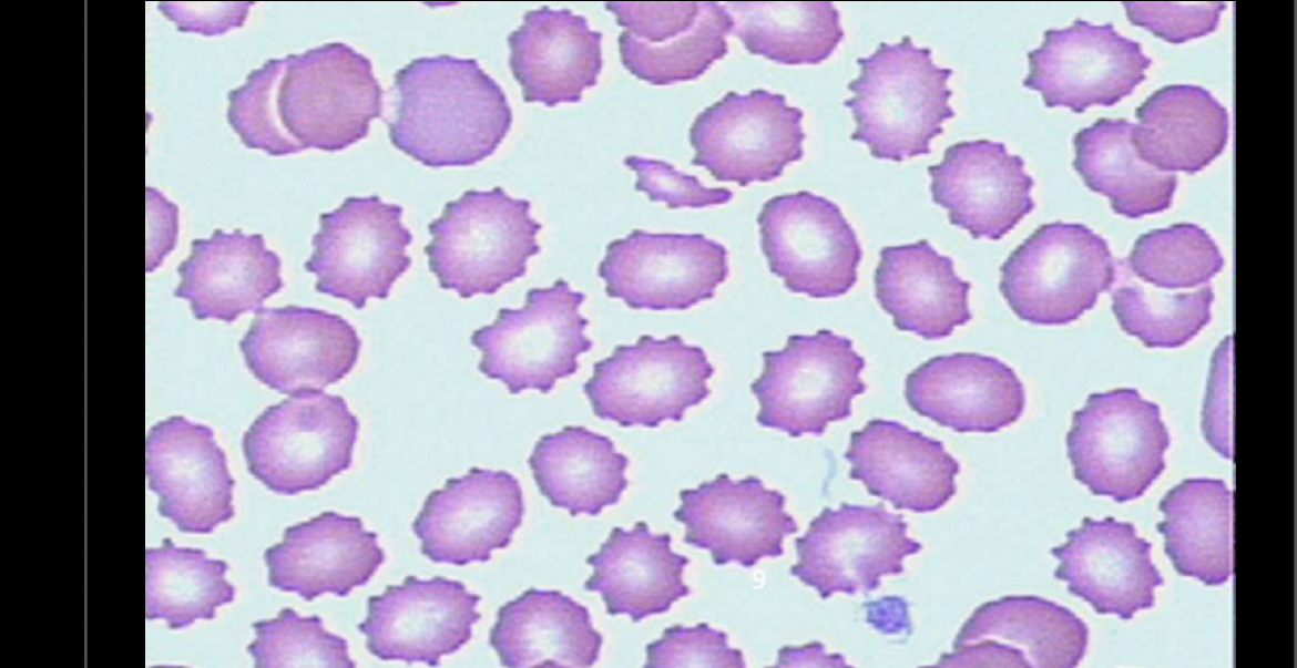 <p>What RBC is this?</p>