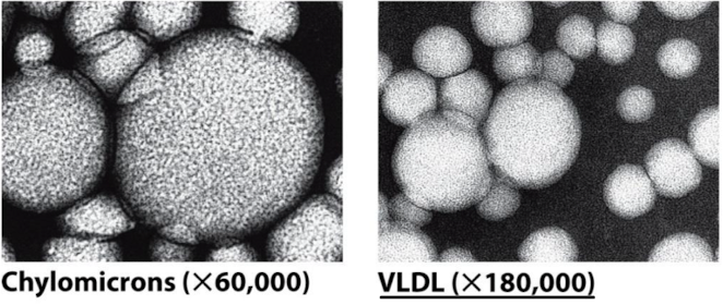 <p>Chylomicrons take the food out of the stomach and deliver fat through the body. Once the inside empties out, it becomes VLDL.</p>