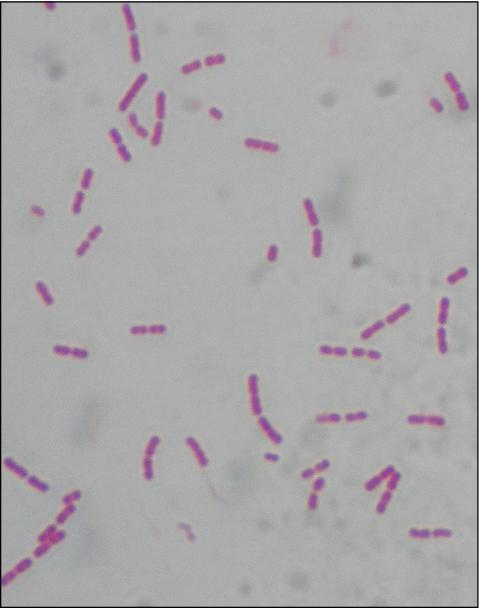 <p> <strong>Lab differentiation:</strong></p><ul><li><p><strong>Gram stain:</strong> Not useful (tiny, intracellular).</p></li><li><p><strong>Microscopy:</strong> Weakly Gram-negative coccobacilli, best seen with Giemsa or GimĆ©nez stains inside endothelial cells.</p></li><li><p><strong>Culture:</strong> Requires living host cells (e.g., tissue culture, embryonated eggs); not grown on routine agar.</p></li><li><p><strong>Tests:</strong> Indirect immunofluorescence assay (IFA) is gold standard. PCR can detect DNA. Weil-Felix test (historical, not specific).</p></li></ul><p><span data-name="woman_health_worker" data-type="emoji">š©āā</span> <strong>Patient scenario:</strong><br>A 12-year-old boy presents in summer with fever, severe headache, and a rash that begins on wrists and ankles then spreads to trunk, palms, and soles. He recalls a recent tick bite during a camping trip. PCR of blood confirms <em>Rickettsia rickettsii</em> infection, consistent with <strong>Rocky Mountain spotted fever (RMSF)</strong>.</p><p><span data-name="clipboard" data-type="emoji">š</span> <strong>Details:</strong><br><strong>(A) Classification:</strong> Obligate intracellular, Gram-negative bacterium; infects endothelial cells.<br><strong>(B) Disease:</strong> Causes <strong>Rocky Mountain spotted fever</strong>, characterized by fever, headache, myalgia, rash, and possible organ failure if untreated.<br><strong>(C) Identification/Diagnosis:</strong> Clinical suspicion is critical (tick exposure, rash). Confirm with serology (IFA), PCR, or tissue biopsy stained for rickettsiae.<br><strong>(D) Treatment/Prevention:</strong> Doxycycline is the treatment of choice, even for children. Prevention: tick avoidance (repellents, protective clothing, tick checks).<br><strong>(E) Unique Epidemiology & Lab Safety:</strong> Transmitted by tick vectors (<em>Dermacentor</em> species). Not spread person-to-person. Work with cultures requires <strong>BSL-3 precautions</strong> due to high risk of aerosol transmission.</p>