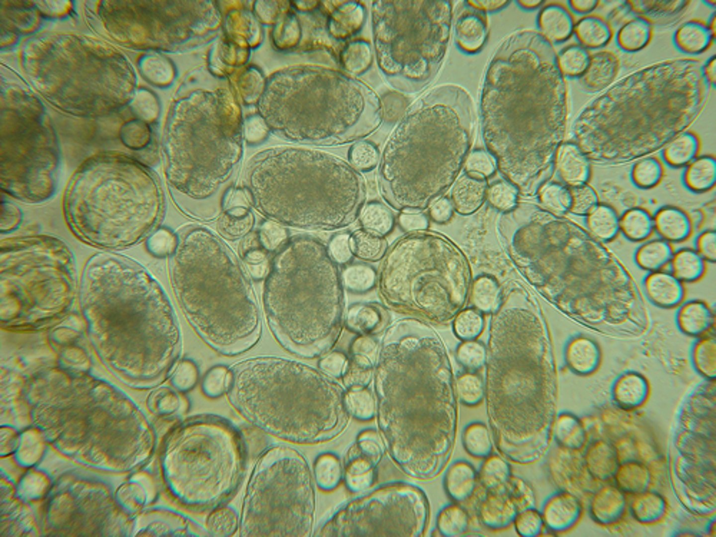 <p>These eggs were found in a fecal sample from a six month old calf born in the Fall of the year. What parasite species should you be most concerned about as the likely culprit for their appearance?</p>