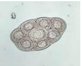<p>Cestode- tapeworm</p>