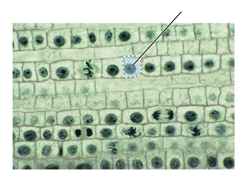 <p>What stage of mitosis is shown by the highlighted cell?</p><p>(Longitudinal section of an onion root tip).</p>