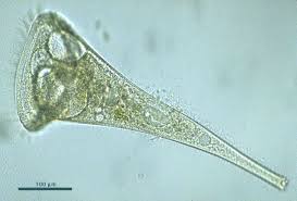 <p>Which protist is this?</p>
