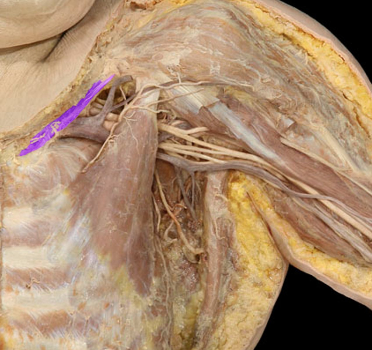 <p>depresses clavicle</p><p>-subclavian nerve</p>