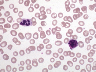 <p>-circulating form (precursor?) of tissue mast cells</p><p>-terminally differentiated</p><p>-contains basophilic granules (granulocytes)</p><p>-granules contain histamine, heparin, etc.</p><p>-IgE receptors</p><p>-involved in allergy</p>