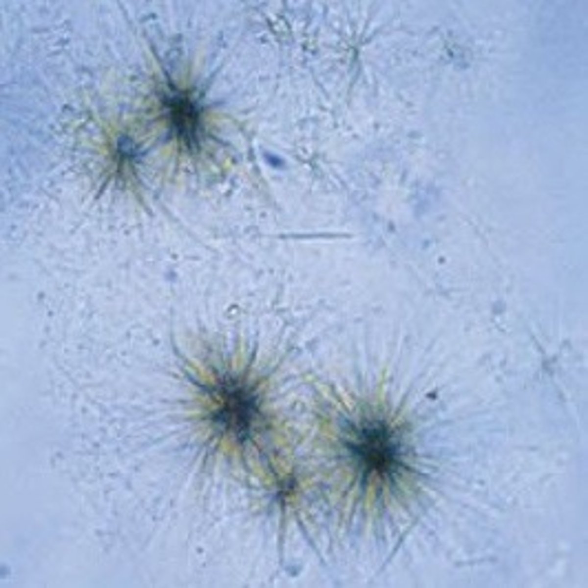 <p>abnormal, fine, colorless to yellow needles in clumps or rosettes, positive bilirubin and seen with leucine crystals, liver disease</p>