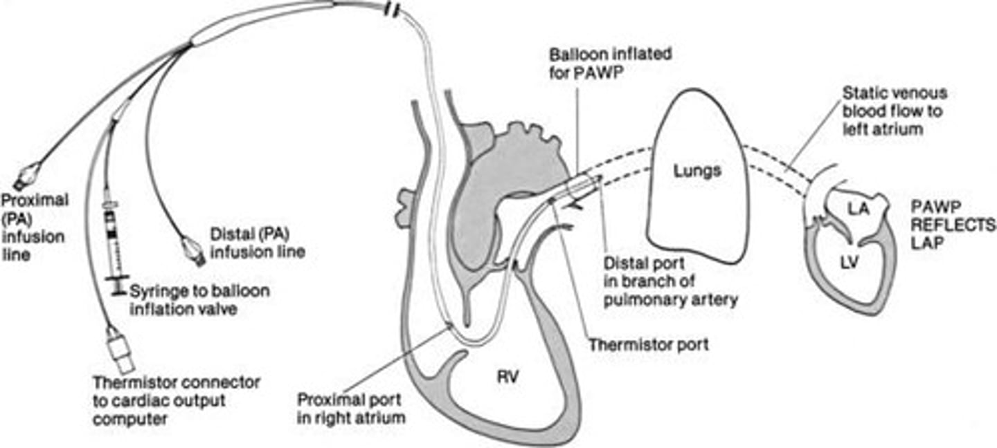 <p>To obtain Pulmonary Artery Occlusion Pressure (PAOP) by inflating with <1.5mL of air.</p>