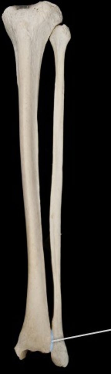 <p>Name the structure.</p>