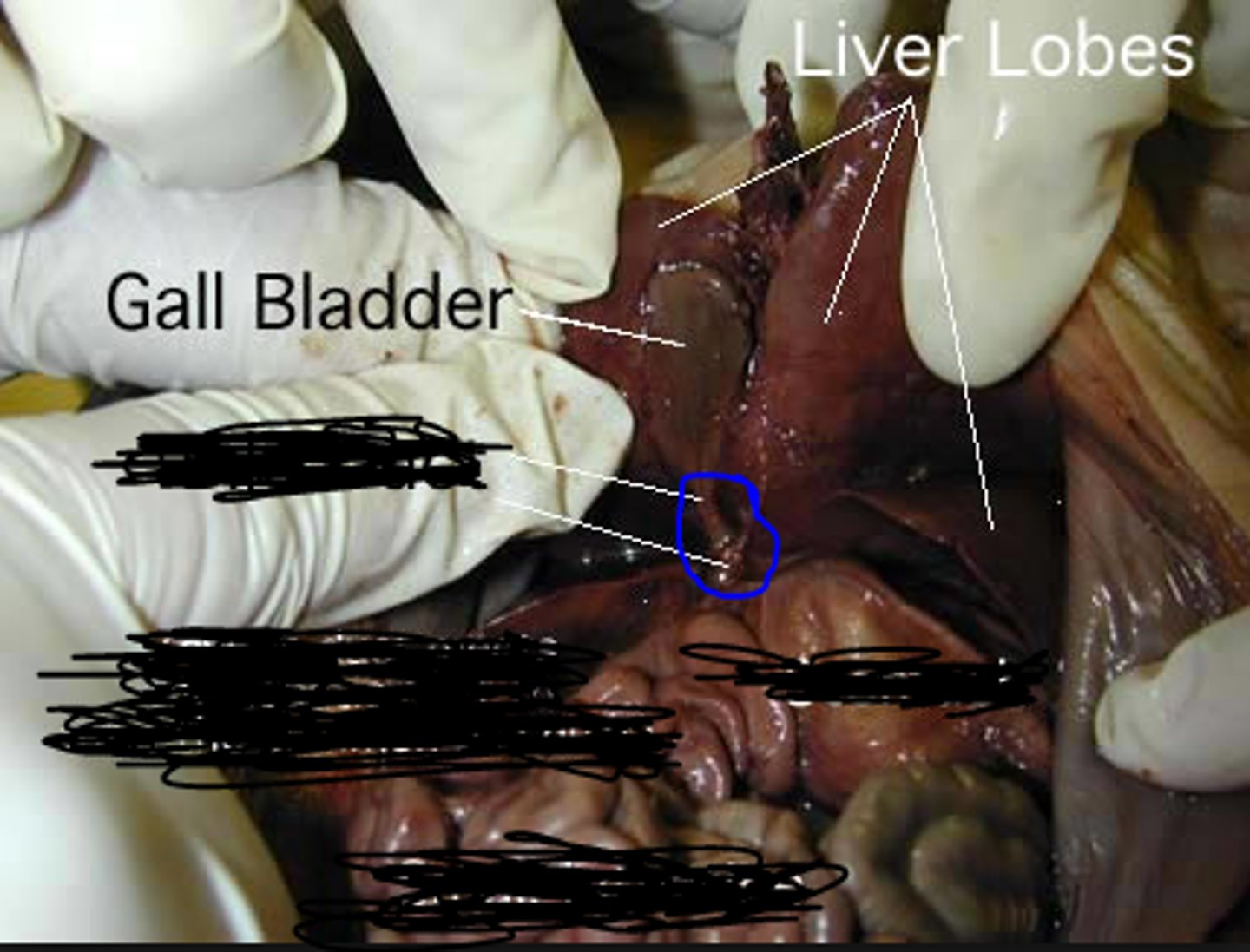 <p>carries bile from the liver and gallbladder to the duodenum</p>