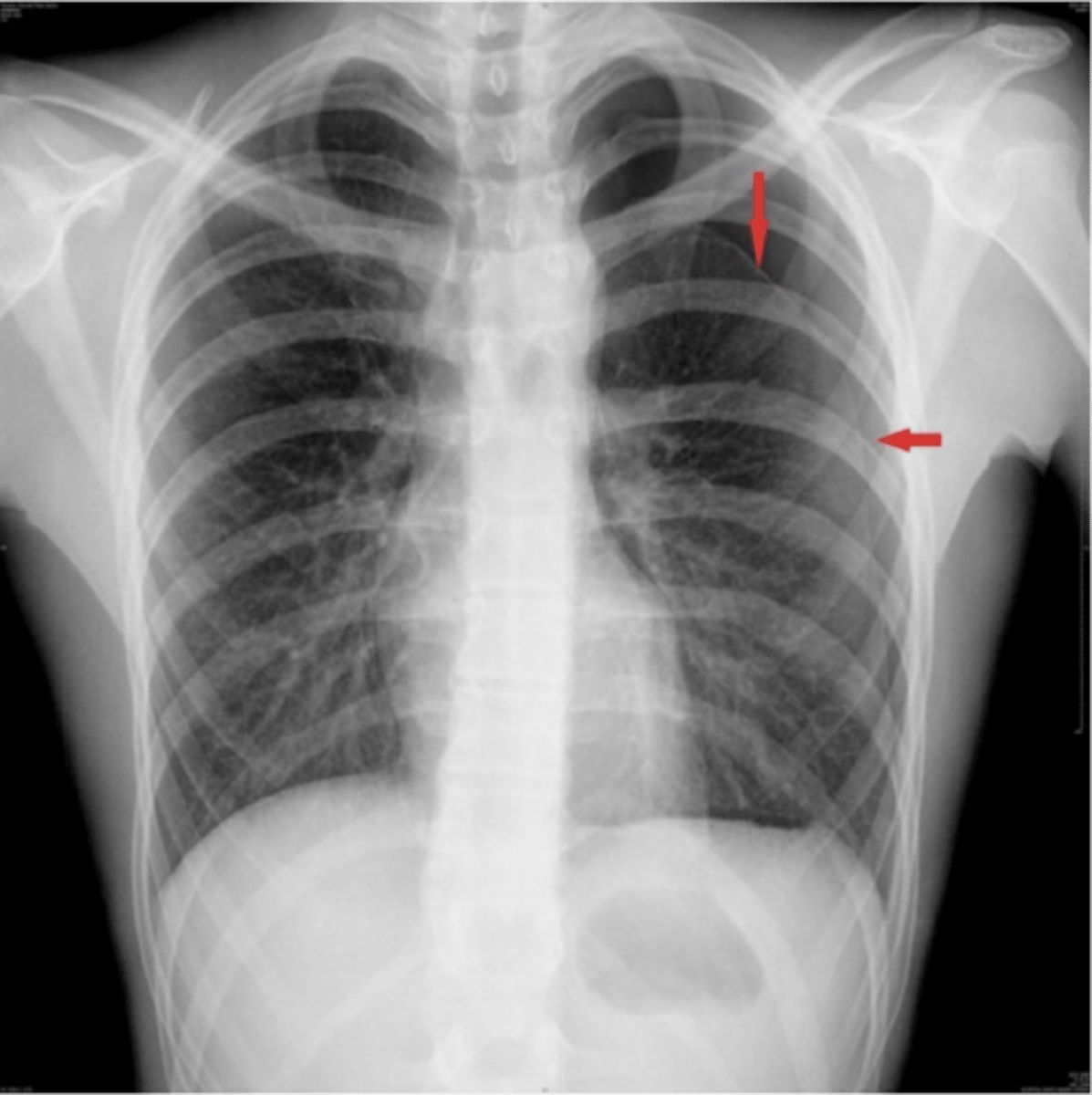 <p>ID</p>