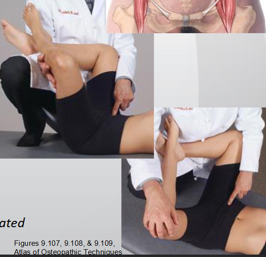 <ul><li><p>1/3 from ASIS to midline, deep post. lat.</p></li><li><p>hip flexion, hip ER + knee flexed</p></li><li><p>F ER</p></li></ul><p></p>