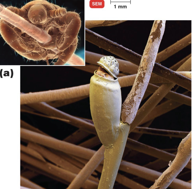 * Pediculus humanus capitis (head louse) 
  * Feed on blood 
  * Lay eggs (nits) on hair 
  * Treated with topical insecticides