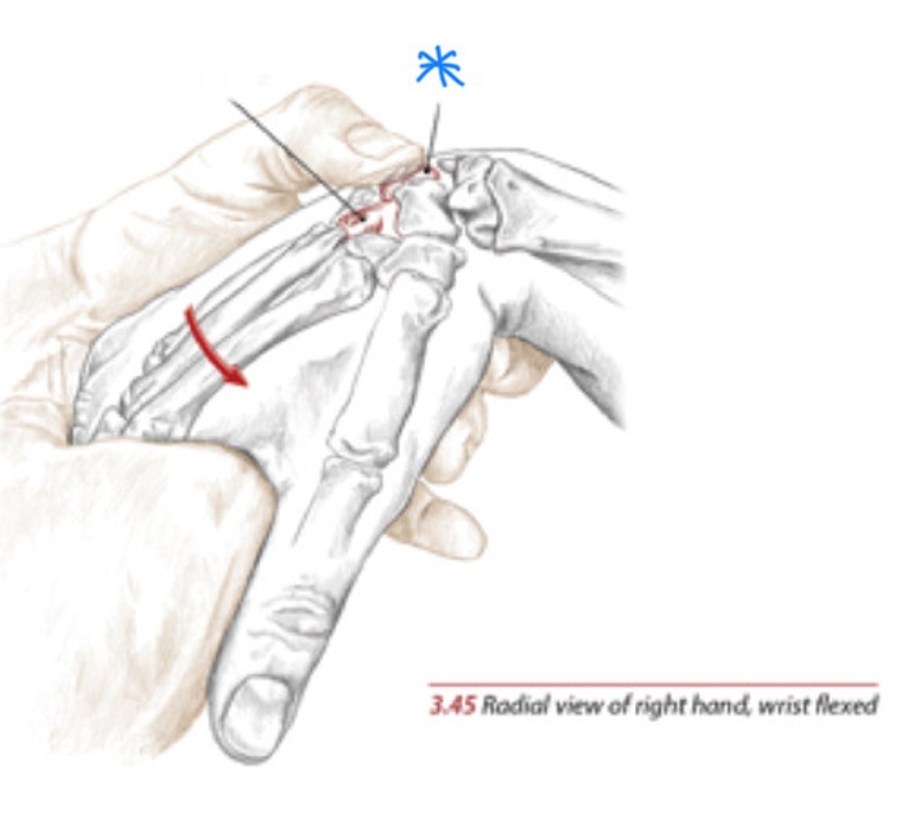 <p>Most frequently dislocated carpal bone, distal to Lister's tubercle</p>