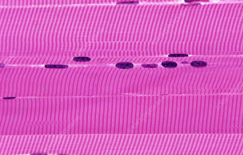 <p>skeletal muscle</p>