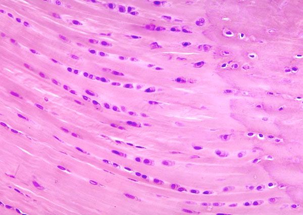 <p>What is the classification of this tissue?</p>