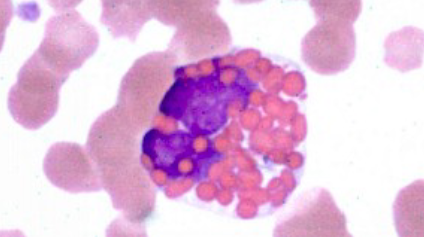 <ul><li><p>looks like a raspberry</p></li></ul><p></p>