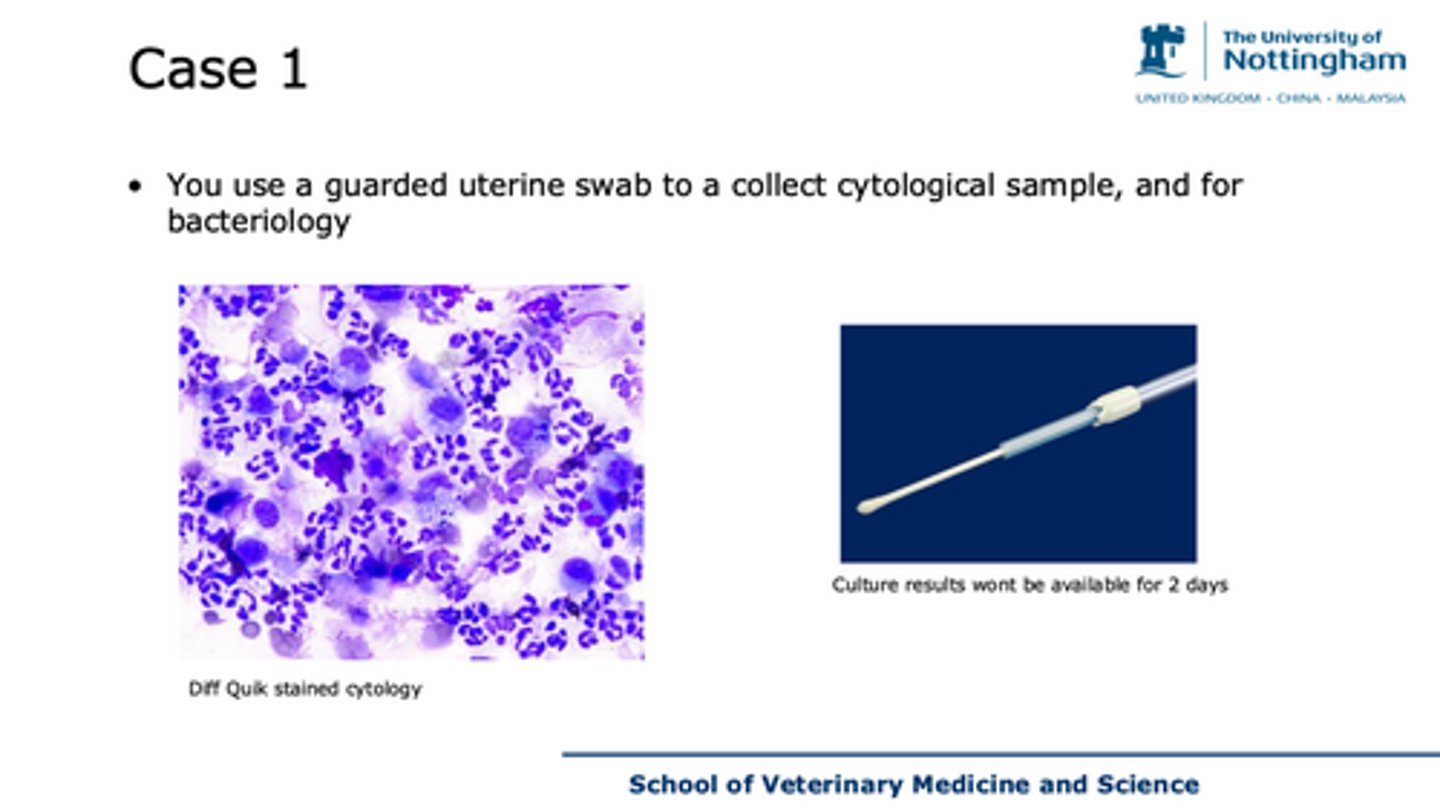 <p>case 1 discuss this cytology?</p>