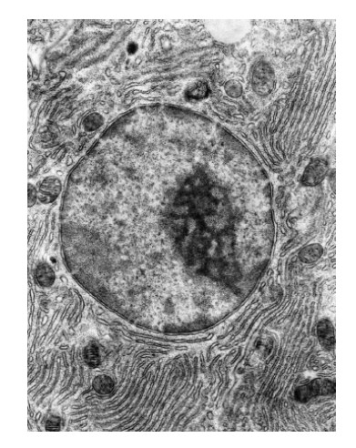 <p><span><span>What describes this rough endoplasmic reticulum?</span></span></p>