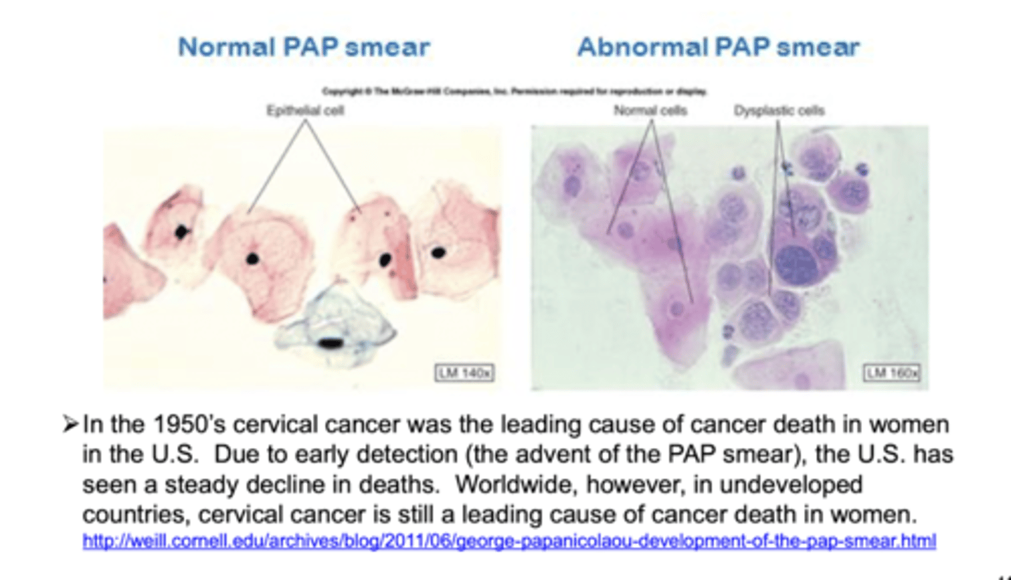 <p>abnormal growth of cervical cells</p>