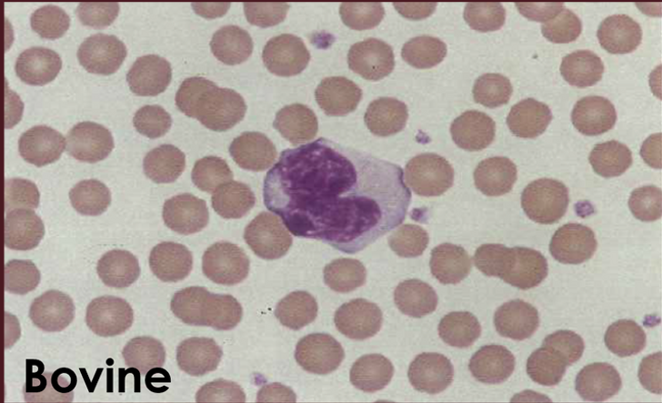 <p>What type of WBC is this?</p>