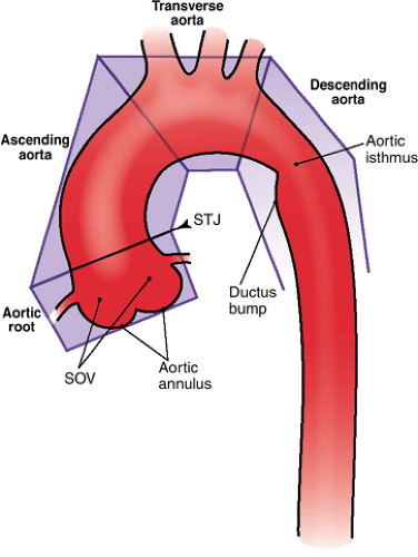 <p>Transverse aortic arch or the aortic knob </p>