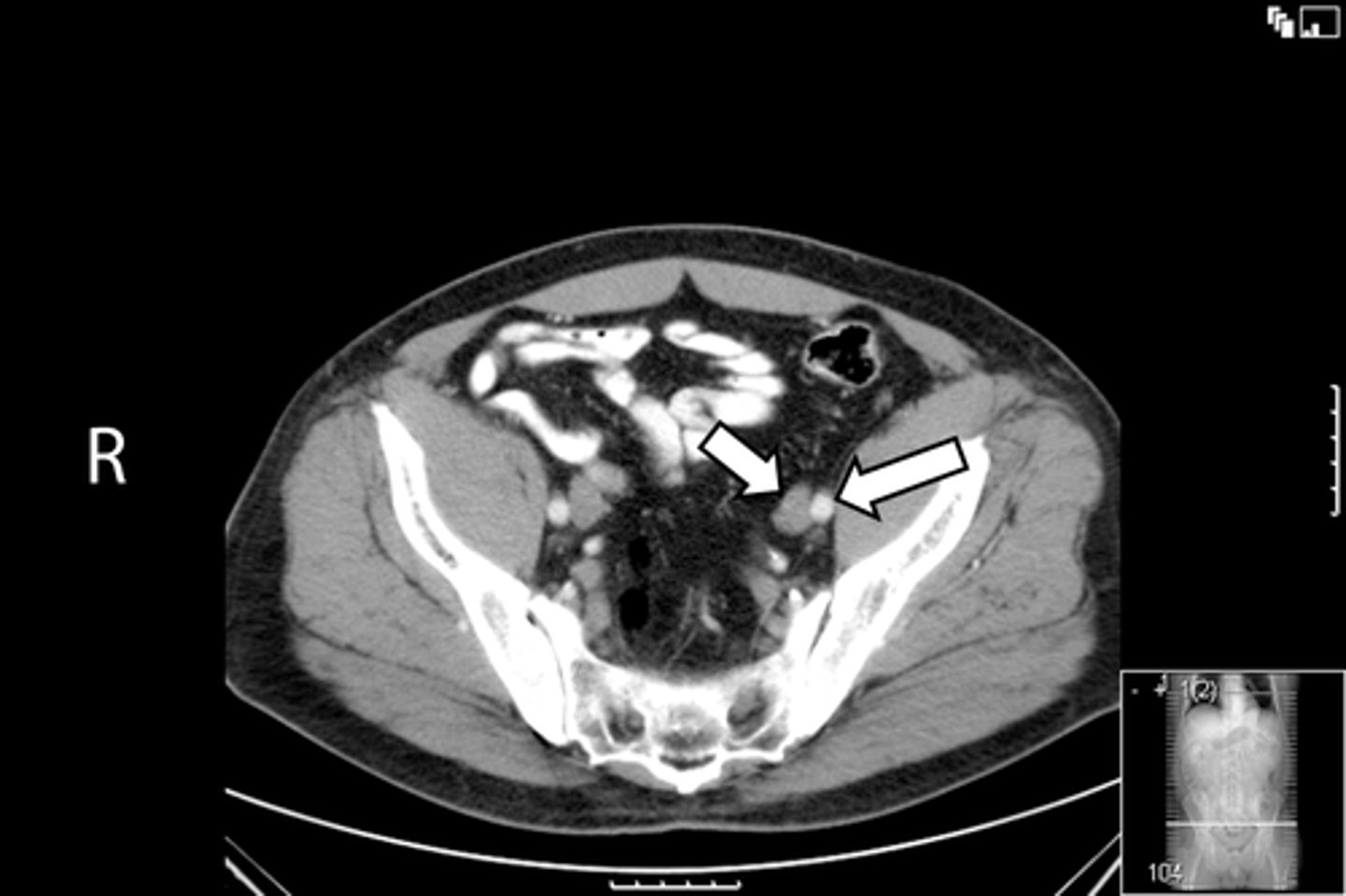 <p>What is indicated in the image?</p>