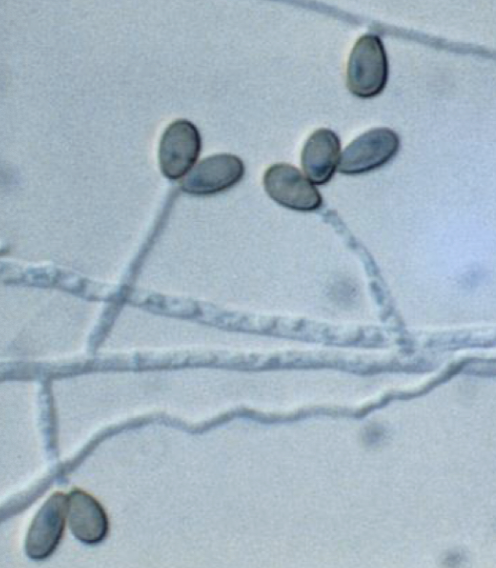<p>Scedosporium spp.</p>