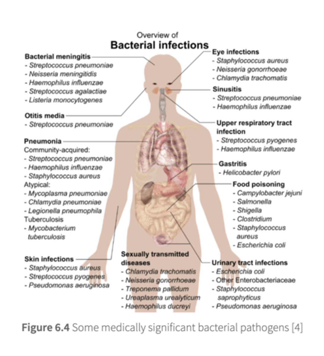 <p>- glycocalyx of streptococcus</p><p>- collagenase and lecithinase of clostridium perfringens breaks down connective tissue (cellulitis) </p><p>- tuberculosis bacillus survives phagocytosis and continues dividing</p><p>- bacteria producing toxins/seek refuge in host cells</p>