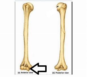 <p>what part of the humerus is this?</p>