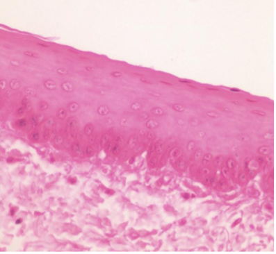 <p>What type of tissue is this? </p>