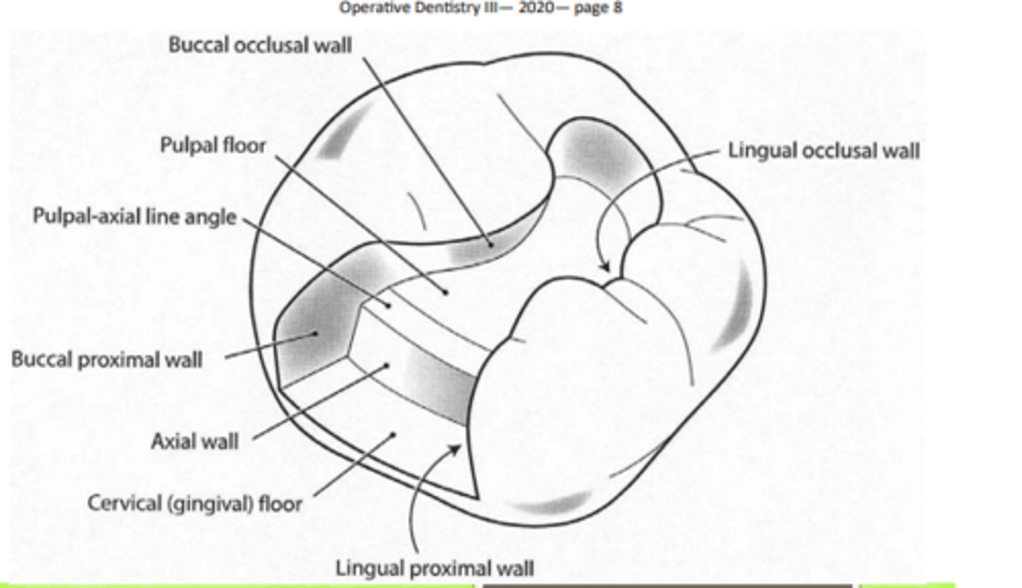 <p>- tooth anatomy (pits/ fissures)</p><p>- adjacent structures (embrasures)</p>