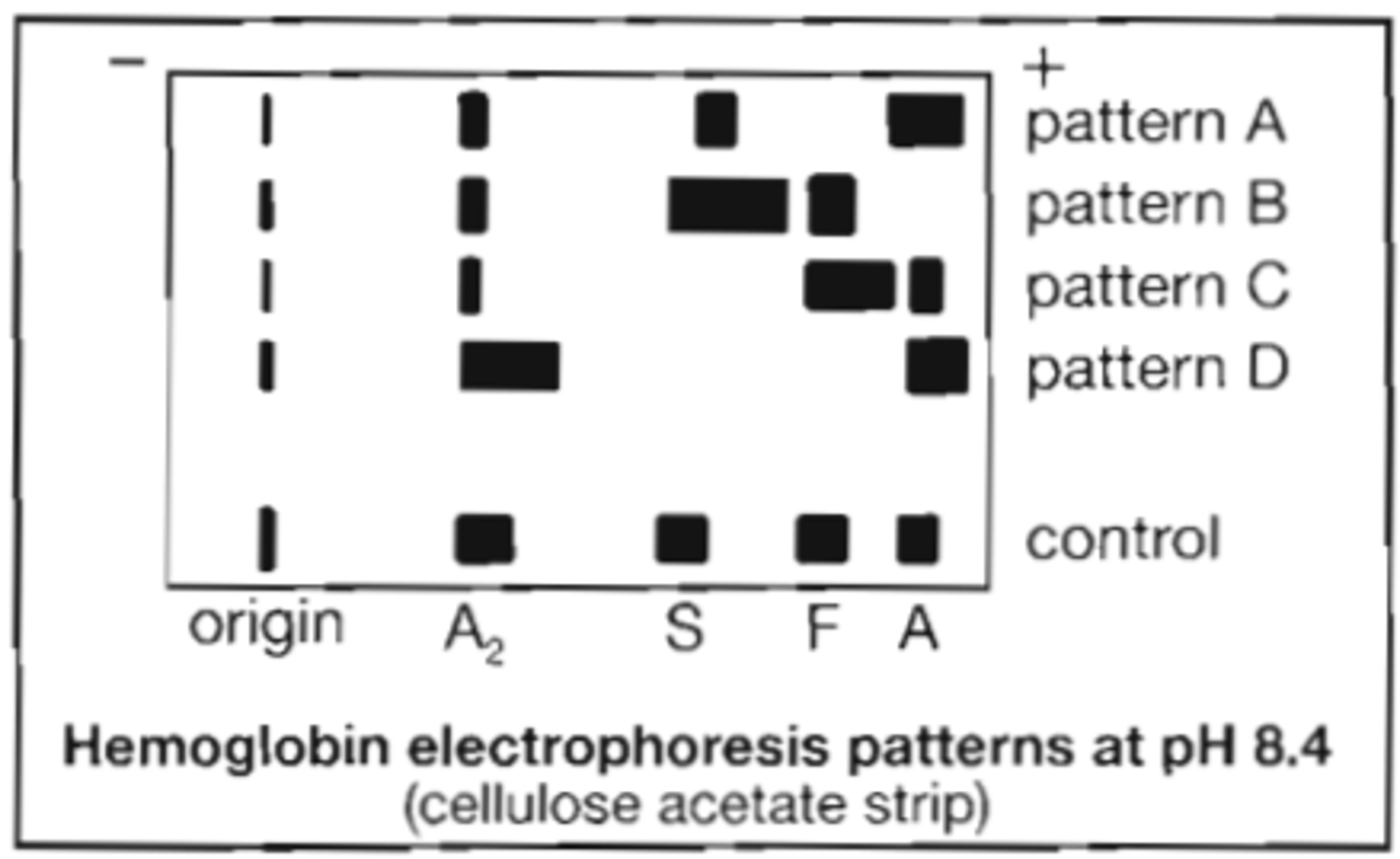 <p>98. Refer to the following illustration:</p><p>Which electrophoresis pattern is consistent with sickle cell trait?</p><p>A. pattern A</p><p>B. pattern B</p><p>C. pattern C</p><p>D. pattern D</p>