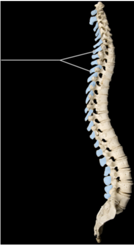 ________ is a condition characterized by the exaggerated lateral bending of the highlighted structure.