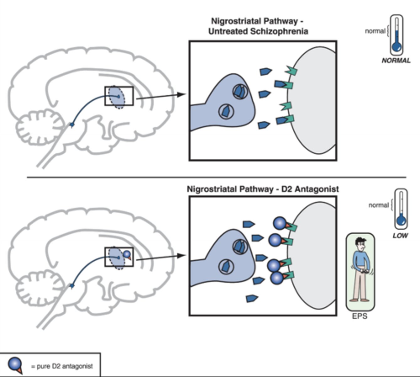 <p>-Cause of parkinsonism</p><p>-Low DA, high ACh</p>