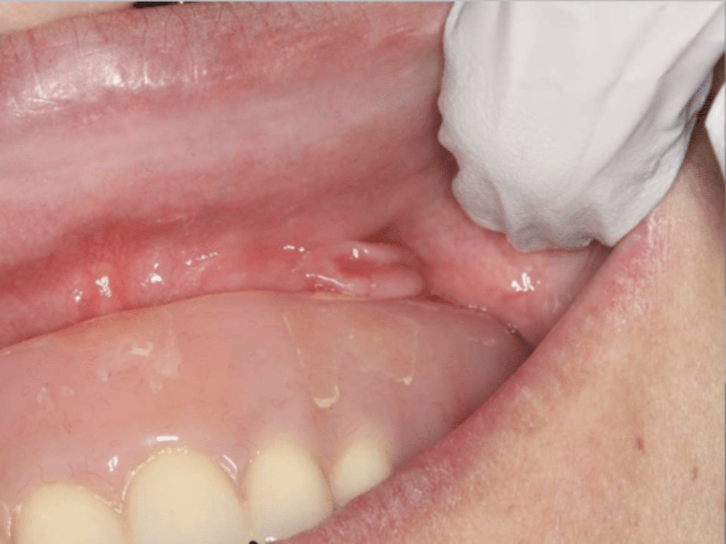 <p>What do you suspect?</p>