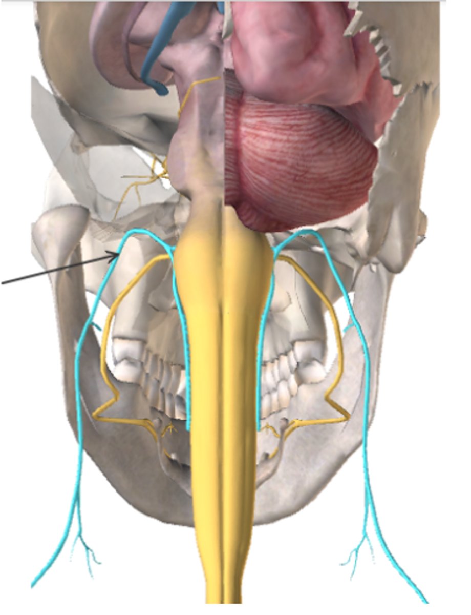 <p>What type of nerve is the cranial nerve below and what does it control? (Highlighted in blue, also indicated by the arrow)</p><p>A. Motor: Shoulder movement</p><p>B. Motor: Eye movement</p><p>C. Sensory: Hearing/Balance</p><p>D. Mixed: Tongue movement and taste</p>