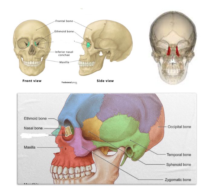 <p><strong>INNER WALL OF EYE SOCKET </strong></p>
