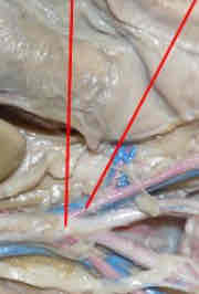 <p>Identify this structure (left arrow)</p>