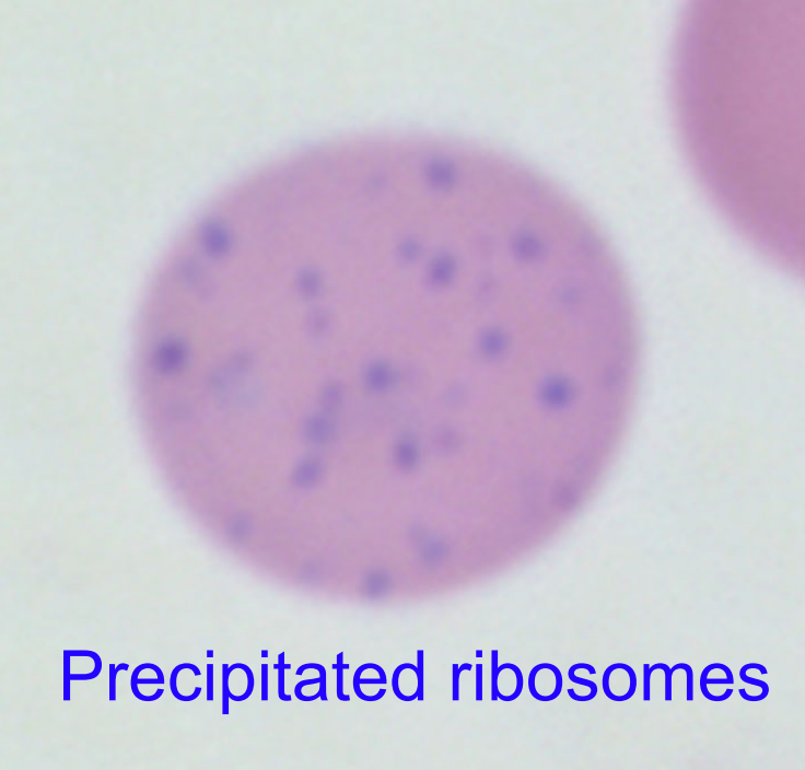 <ul><li><p><strong>precipitated ribosomes</strong> in immature RBCs (reticulocyte or polychromatophil)</p></li><li><p>normal feature of ruminant reticulocytes</p></li><li><p>may be seen with regenerative anemia in ruminants; severe regen. anemia in dogs, cats</p></li><li><p>pathologically seen with lead toxicity</p></li></ul><p></p>