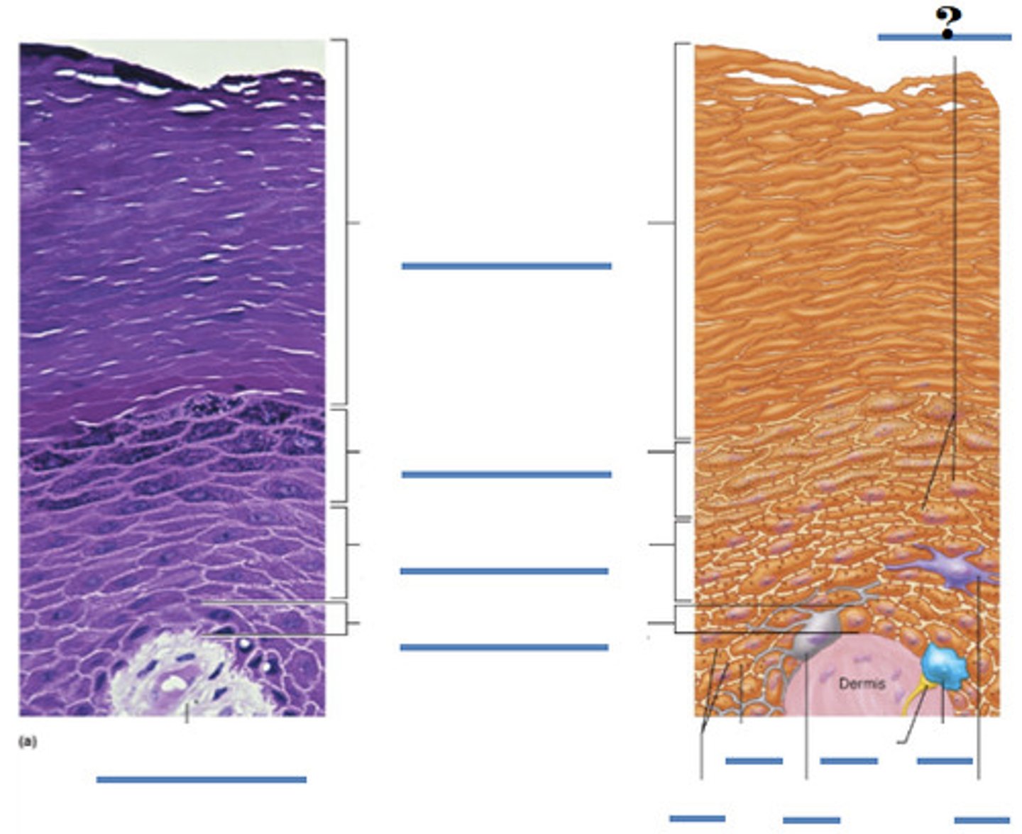 <p>primary cell type in epidermis, produce keratin which is a fibrous protein that gives protection properties; produced by stem cells in stratum basale; pushed through the layers of skin as new cells are formed; die by apoptosis as distance from capillaries increase; cells slough off as dander and dandruff</p>