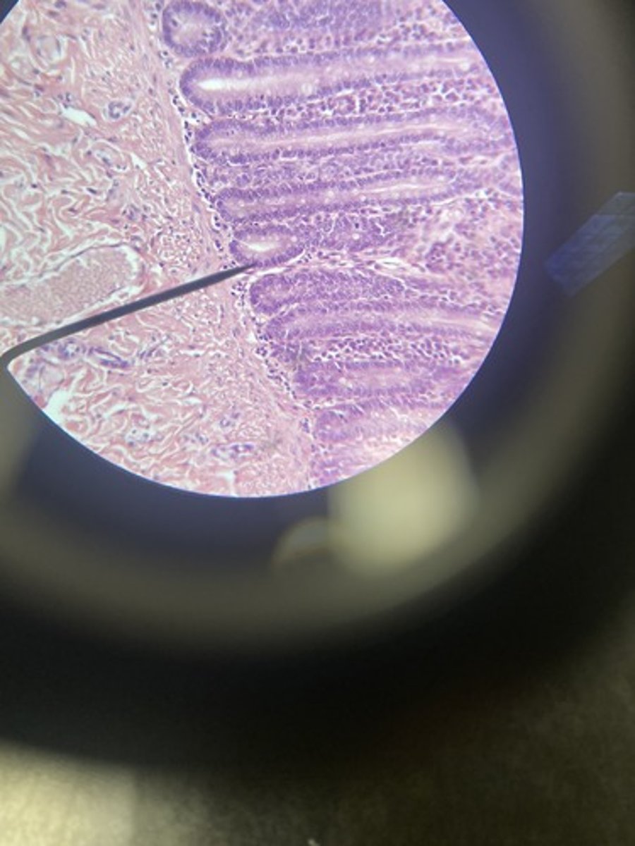<p>What type of epithelium</p>