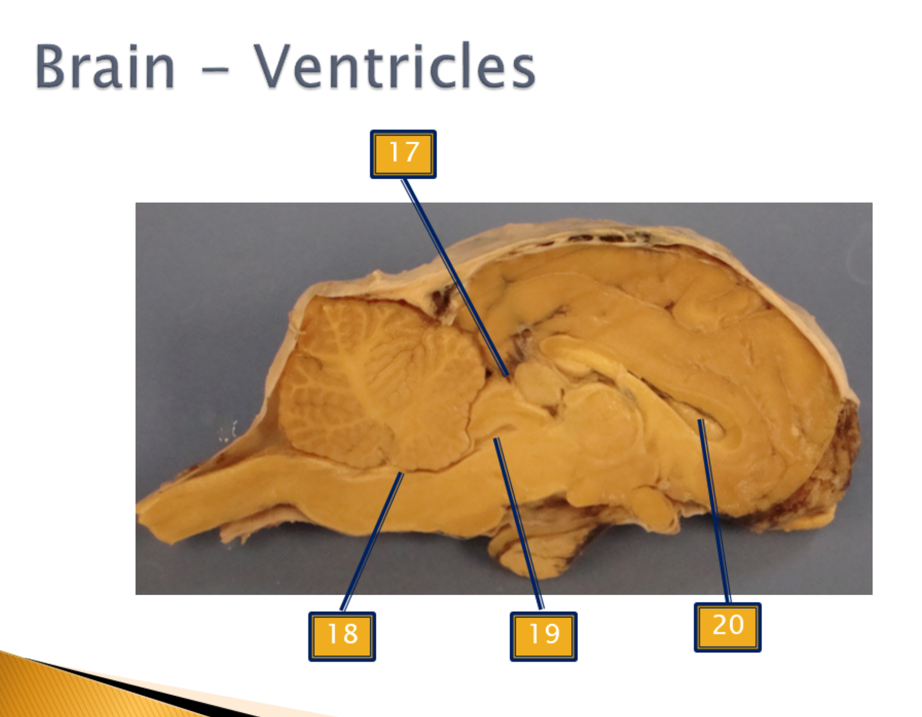 <p>Ventricles</p>
