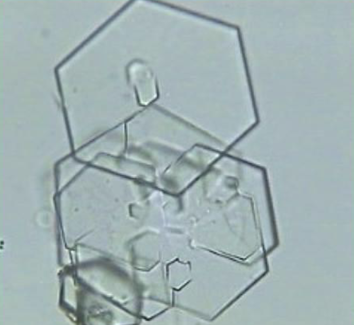 <p><span style="color: #000000">What is this crystal?</span></p><p><span style="color: #000000">Do these crystals like </span><span style="color: #000000">alkaline or acidic</span><span style="color: #000000"> urine?</span></p><p><span style="color: #000000">Why are these crystals </span><span style="color: #000000">present</span><span style="color: #000000"> in urine?</span></p>