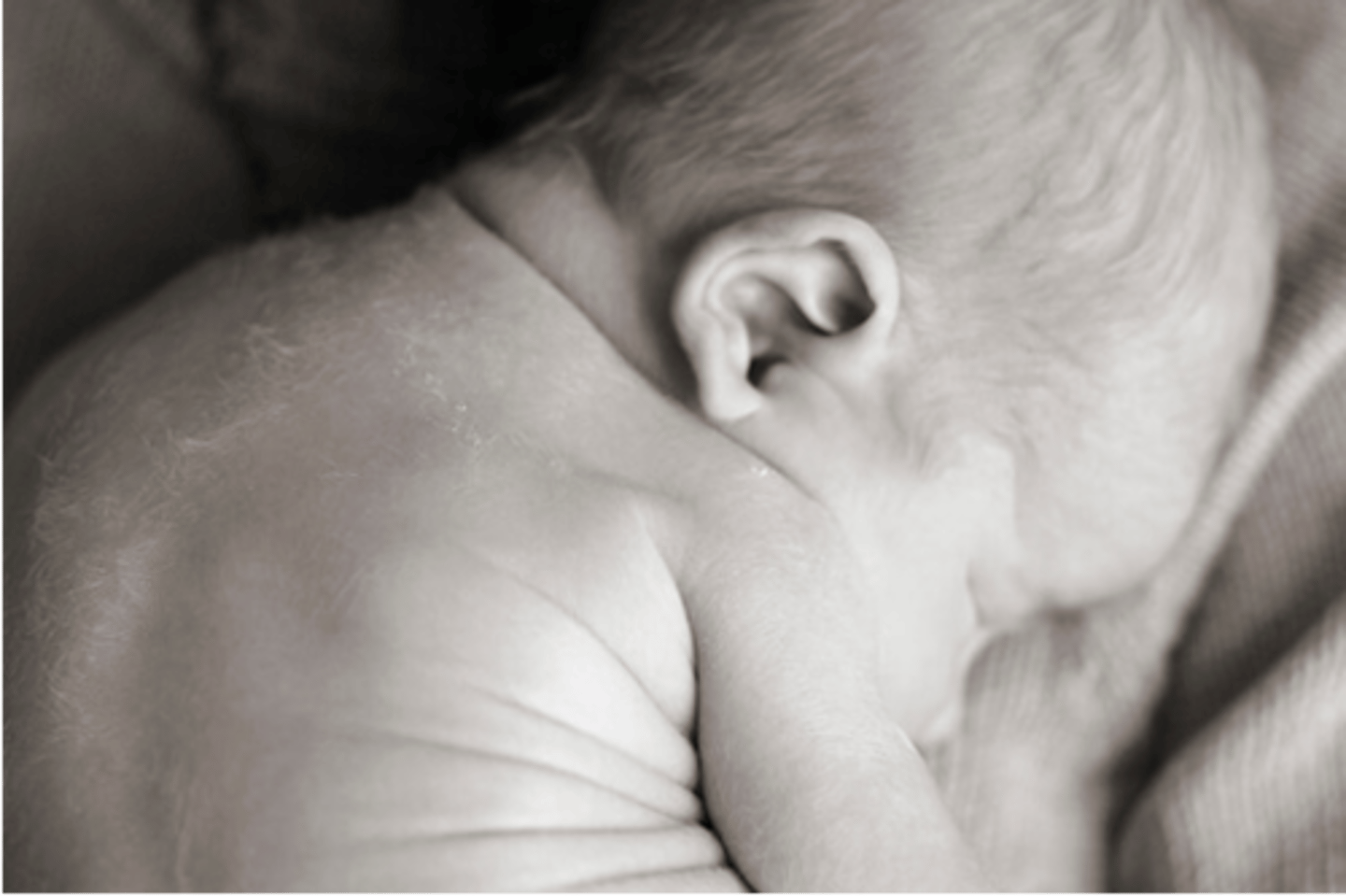 <p>fine downy growth of hair over the entire body, especially shoulders and back</p><p>prominent in premature infants- this hair is generally shed in the first few weeks</p>