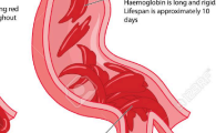 <p>thickened, slow-moving blood due to dehydration or circulatory stasis</p>