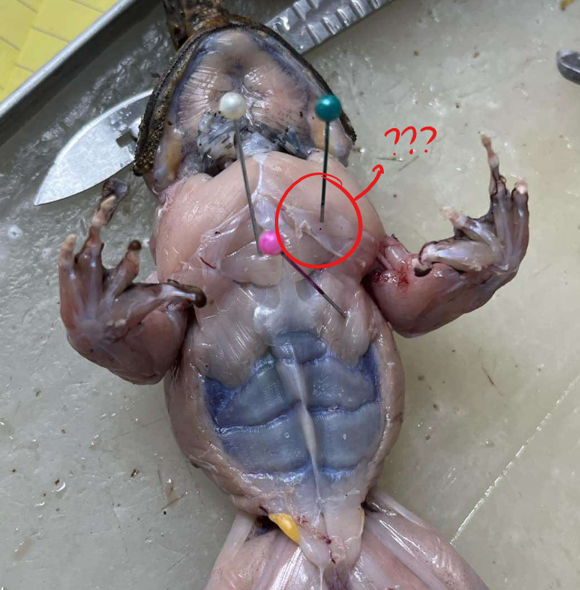 <p>anterior muscle of the chest just next to the sternoradialis</p>