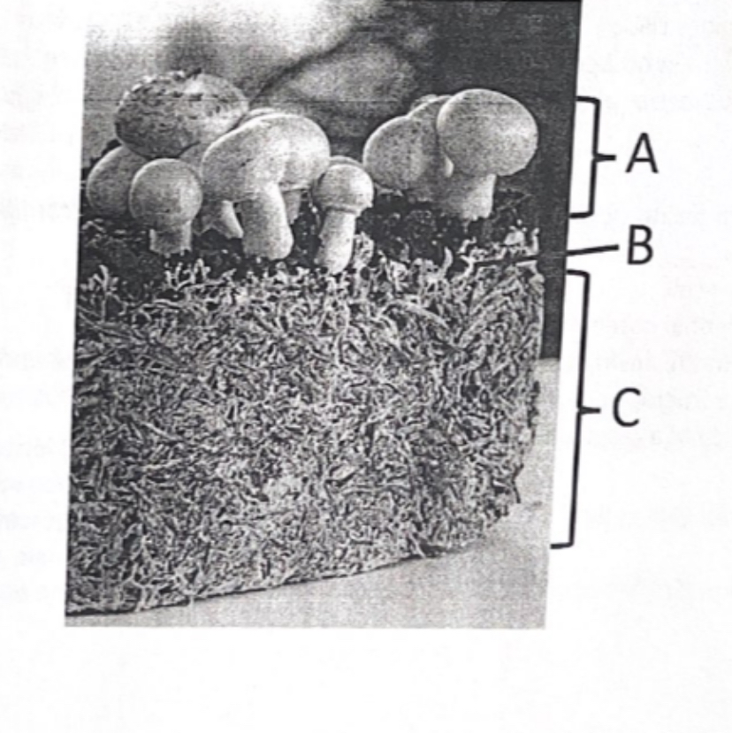 <p><span>The figure shown below is an image of<br>____, showing (A) ___ (B)____and (C) ____</span></p>