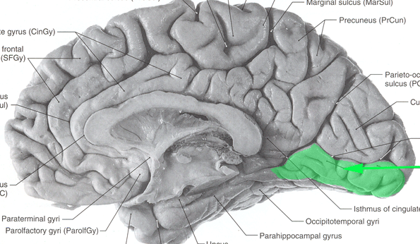 <p>identify the structure</p>