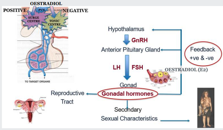 <p>More complex: Hypothalamic surge and tonic centres respond differently to oestradiol feedback</p><p></p><p>This diagram is explaining the f<span style="color: purple;">emale HPG axis and the menstrual cycle regulation.</span></p><p class="font-claude-response-body break-words whitespace-normal leading-[1.7]">Here's what it shows:</p><p class="font-claude-response-body break-words whitespace-normal leading-[1.7]"><span style="color: purple;">The HPG Axis (right side):</span></p><ul><li><p><span style="color: purple;">Hypothalamus releases GnRH</span></p></li><li><p><span style="color: purple;">Anterior Pituitary Gland releases LH and FSH</span></p></li><li><p><span style="color: purple;">Gonad (ovary) produces estradiol (E2) and other gonadal hormones</span></p></li><li><p><span style="color: purple;">These hormones act on the reproductive tract and create secondary sexual characteristics</span></p></li></ul><p></p><p>Key difference from the male diagram: The feedback is labeled as "+ve &amp; -ve" (positive and negative), which is unique to females:</p><ul><li><p>Negative feedback: <span style="color: purple;">Most of the time, estradiol inhibits GnRH/LH/FSH </span>release (similar to males)</p></li><li><p>Positive feedback: At mid-cycle w<span style="color: purple;">hen estradiol levels peak, it actually <em>stimulates</em> a surge of LH and FSH, triggering ovulation</span></p></li></ul><p class="font-claude-response-body break-words whitespace-normal leading-[1.7]">The brain diagram (top left): Shows the "surge centre" and "tonic centre" in the hypothalamus, illustrating how estradiol can have both<span style="color: purple;"> positive (surge) and negative (tonic) feedback </span>effects depending on timing and estradiol levels during the menstrual cycle.</p>