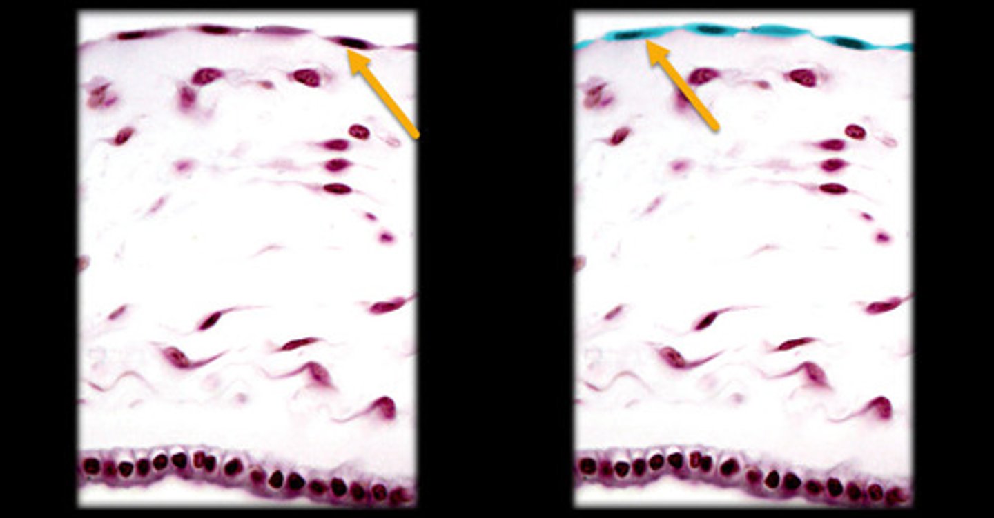 <p>- Single layer of flat, thin cells.</p><p>- Nucleus is disc-shaped and centrally located.</p><p>- Appears as a smooth, tile-like sheet under the microscope.</p><p>- Found in areas such as blood vessels and body cavities.</p><p>- Ideal for diffusion and filtration, and has a nearly transparent appearance.</p>